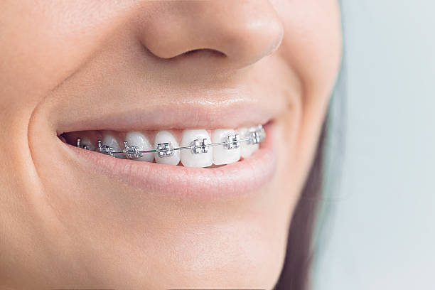 Catalina, AZ Dental Services Company